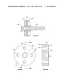 SHAPE-FIT GLENOID REAMING SYSTEMS AND METHODS diagram and image