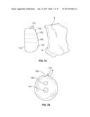 SHAPE-FIT GLENOID REAMING SYSTEMS AND METHODS diagram and image