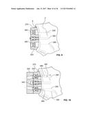 SHAPE-FIT GLENOID REAMING SYSTEMS AND METHODS diagram and image