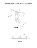 SHAPE-FIT GLENOID REAMING SYSTEMS AND METHODS diagram and image