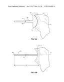 SHAPE-FIT GLENOID REAMING SYSTEMS AND METHODS diagram and image