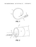 ENDOSCOPIC TISSUE MANIPULATION TOOL diagram and image