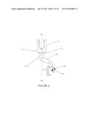 Percutaneous Pedicle Screw Revision System diagram and image