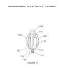 Percutaneous Pedicle Screw Revision System diagram and image