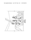 SYSTEMS AND METHODS FOR PERCUTANEOUS SPINAL FUSION diagram and image