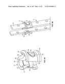 SYSTEMS AND METHODS FOR PERCUTANEOUS SPINAL FUSION diagram and image