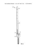 SYSTEMS AND METHODS FOR PERCUTANEOUS SPINAL FUSION diagram and image