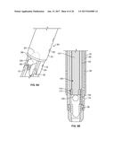 SYSTEMS AND METHODS FOR PERCUTANEOUS SPINAL FUSION diagram and image