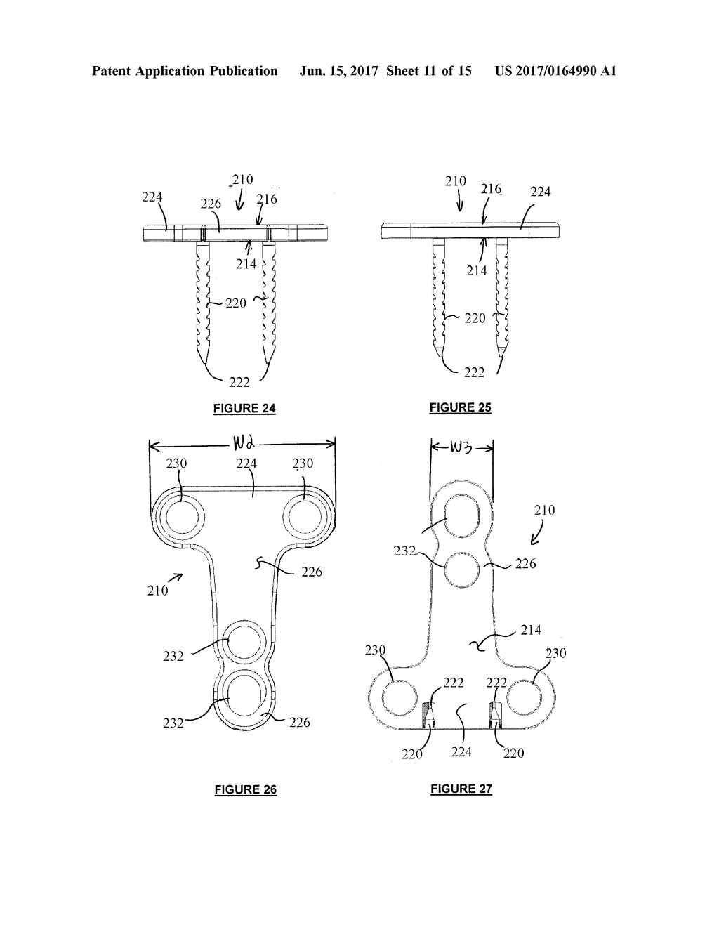 BONE FIXATION DEVICES AND METHODS - diagram, schematic, and image 12