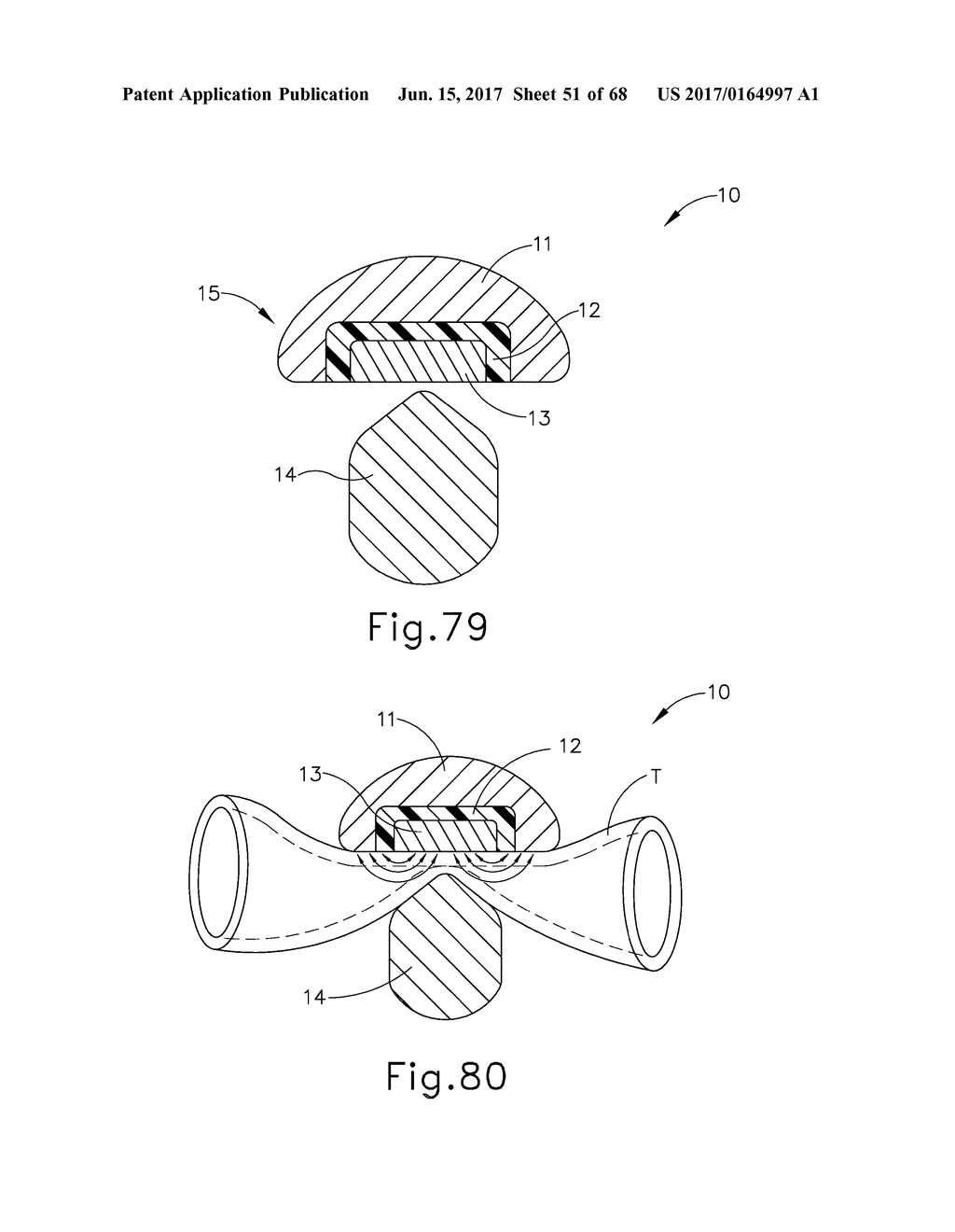 METHOD OF TREATING TISSUE USING END EFFECTOR WITH ULTRASONIC AND     ELECTROSURGICAL FEATURES - diagram, schematic, and image 52