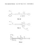 Method and Apparatus for Tissue Ablation diagram and image