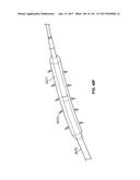 Method and Apparatus for Tissue Ablation diagram and image