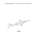 Method and Apparatus for Tissue Ablation diagram and image