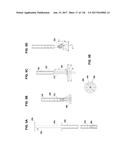 Method and Apparatus for Tissue Ablation diagram and image