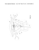 Method and Apparatus for Tissue Ablation diagram and image