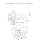 Method and Apparatus for Tissue Ablation diagram and image