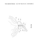 Method and Apparatus for Tissue Ablation diagram and image