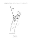 Method and Apparatus for Tissue Ablation diagram and image