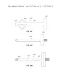 Method and Apparatus for Tissue Ablation diagram and image