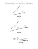 Method and Apparatus for Tissue Ablation diagram and image