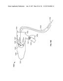 Method and Apparatus for Tissue Ablation diagram and image