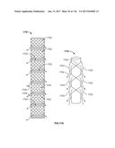 Method and Apparatus for Tissue Ablation diagram and image