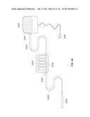 Method and Apparatus for Tissue Ablation diagram and image