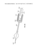 Method and Apparatus for Tissue Ablation diagram and image