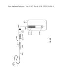 Method and Apparatus for Tissue Ablation diagram and image