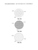 Method and Apparatus for Tissue Ablation diagram and image