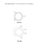 Method and Apparatus for Tissue Ablation diagram and image