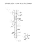 Method and Apparatus for Tissue Ablation diagram and image