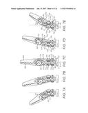 SURGICAL INSTRUMENT SHAFT SPOKES diagram and image