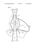 HEART VALVE PROSTHESIS FOR PERCUTANEOUS REPLACEMENT OF A TRICUSPID VALVE,     AND SYSTEM COMPRISING A HEART VALVE PROSTHESIS OF SAID TYPE diagram and image