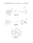 DEVICES AND METHODS FOR CREATING WEDGE-SHAPED RECESSES diagram and image