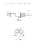 DEVICES AND METHODS FOR CREATING WEDGE-SHAPED RECESSES diagram and image