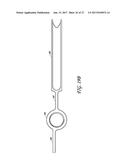 DEVICES AND METHODS FOR CREATING WEDGE-SHAPED RECESSES diagram and image