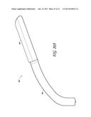 DEVICES AND METHODS FOR CREATING WEDGE-SHAPED RECESSES diagram and image