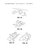 APPARATUS AND METHOD FOR CONSTRUCTING IMPLANTABLE CARTILAGE STRUCTURES diagram and image