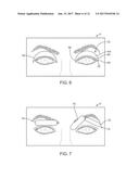 DRY EYE TREATMENT SYSTEMS diagram and image