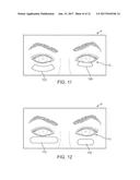 DRY EYE TREATMENT SYSTEMS diagram and image