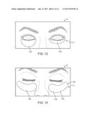 DRY EYE TREATMENT SYSTEMS diagram and image