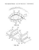 DRY EYE TREATMENT SYSTEMS diagram and image