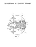 OCULAR IMPLANT DELIVERY DEVICE AND METHOD diagram and image