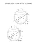 PATCH FOR SEALING RETINAL BREAKS AND ASSOCIATED DEVICES, SYSTEMS, AND     METHODS diagram and image