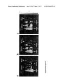 ANTIBIOTIC PROTOCELLS AND RELATED PHARMACEUTICAL FORMULATIONS AND METHODS     OF TREATMENT diagram and image