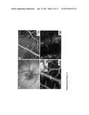 ANTIBIOTIC PROTOCELLS AND RELATED PHARMACEUTICAL FORMULATIONS AND METHODS     OF TREATMENT diagram and image