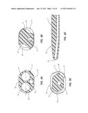 Catheter Assembly Including a Multi-Lumen Configuration diagram and image