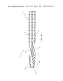 Catheter Assembly Including a Multi-Lumen Configuration diagram and image