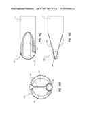 Catheter Assembly Including a Multi-Lumen Configuration diagram and image